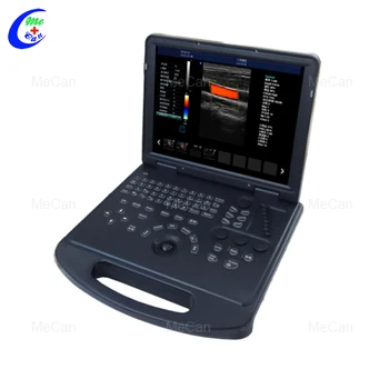 MCB-C60 15-дюймовый портативный ультразвуковой сканер для ноутбука с цветной допплерографией 3D 4D